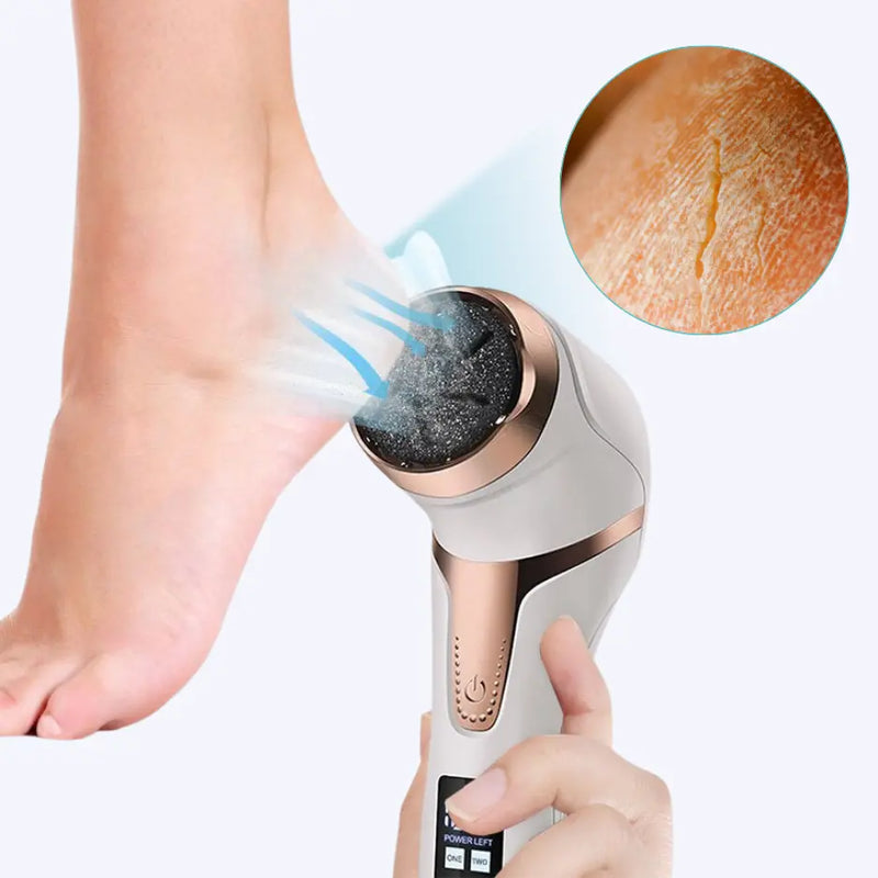 PediPro™ Elektrischer Fußschwielenentferner